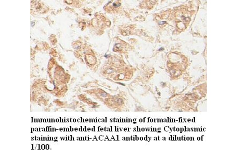 ACAA1 Antibody from Signalway Antibody (39398) - Antibodies.com