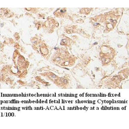 ACAA1 Antibody from Signalway Antibody (39398) - Antibodies.com