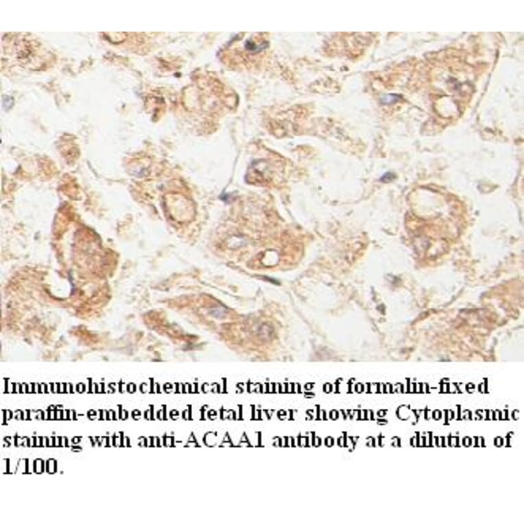 ACAA1 Antibody from Signalway Antibody (39398) - Antibodies.com