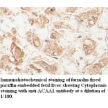 ACAA1 Antibody from Signalway Antibody (39398) - Antibodies.com
