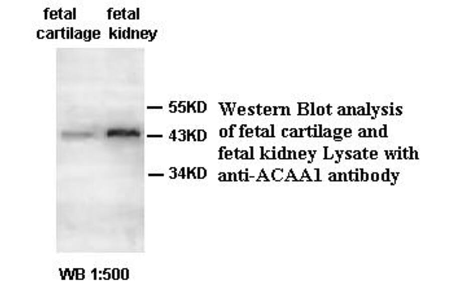 ACAA1 Antibody from Signalway Antibody (39398) - Antibodies.com