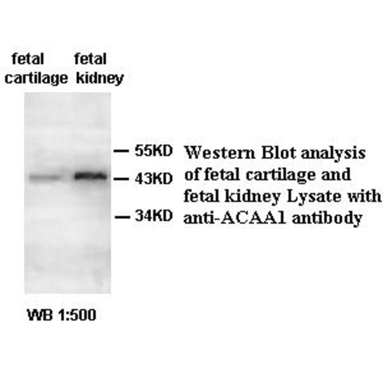 ACAA1 Antibody from Signalway Antibody (39398) - Antibodies.com