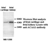 ACAA1 Antibody from Signalway Antibody (39398) - Antibodies.com
