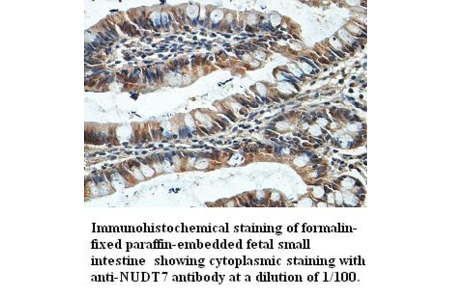 NUDT7 Antibody from Signalway Antibody (39404) - Antibodies.com
