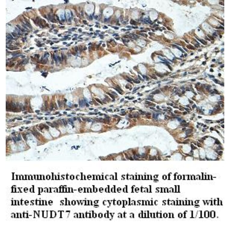 NUDT7 Antibody from Signalway Antibody (39404) - Antibodies.com