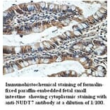 NUDT7 Antibody from Signalway Antibody (39404) - Antibodies.com