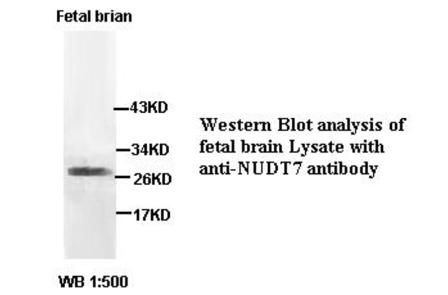 NUDT7 Antibody from Signalway Antibody (39404) - Antibodies.com