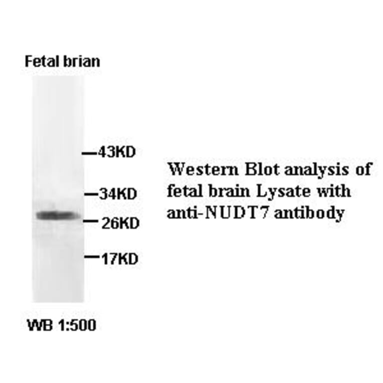 NUDT7 Antibody from Signalway Antibody (39404) - Antibodies.com