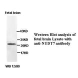 NUDT7 Antibody from Signalway Antibody (39404) - Antibodies.com
