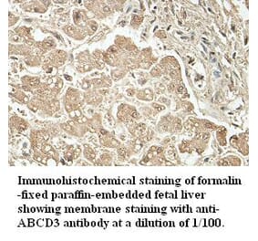 ABCD3 Antibody from Signalway Antibody (39411) - Antibodies.com
