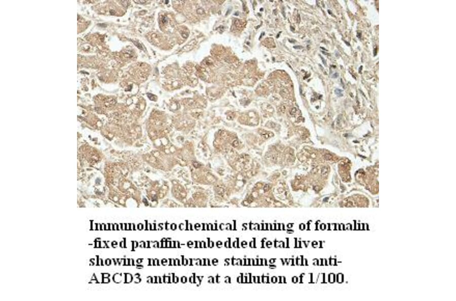 ABCD3 Antibody from Signalway Antibody (39411) - Antibodies.com