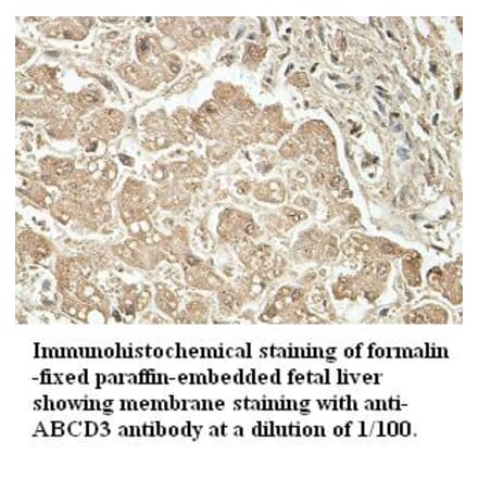 ABCD3 Antibody from Signalway Antibody (39411) - Antibodies.com