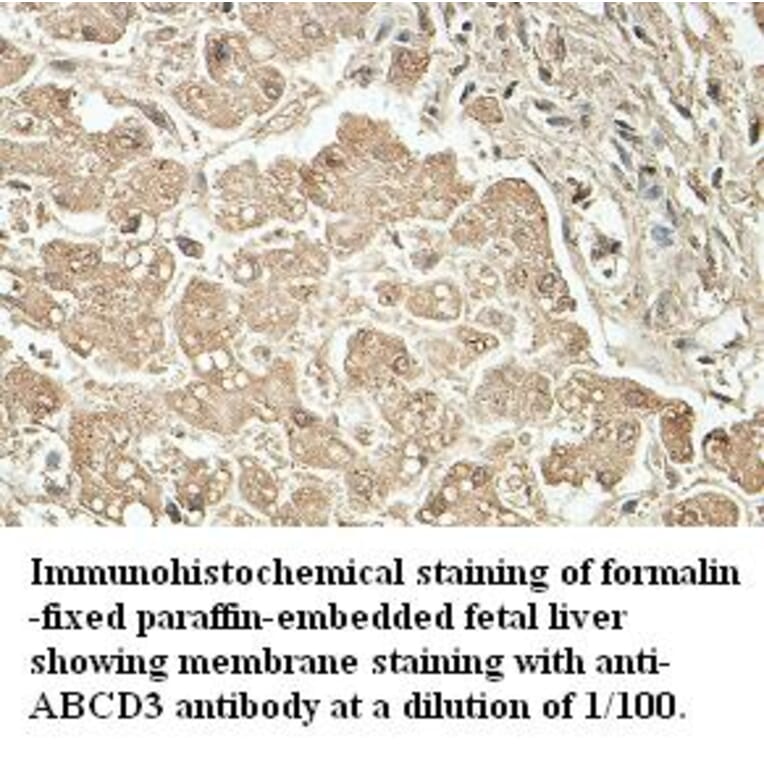 ABCD3 Antibody from Signalway Antibody (39411) - Antibodies.com