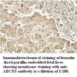ABCD3 Antibody from Signalway Antibody (39411) - Antibodies.com