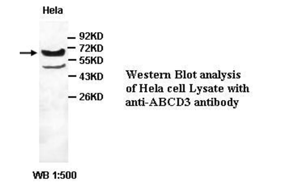 ABCD3 Antibody from Signalway Antibody (39411) - Antibodies.com