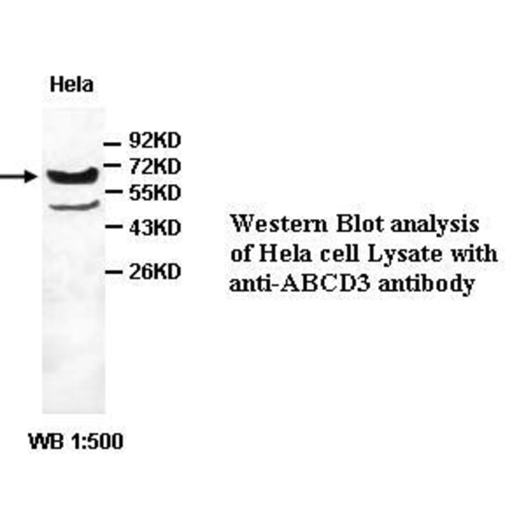 ABCD3 Antibody from Signalway Antibody (39411) - Antibodies.com