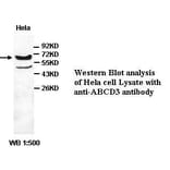 ABCD3 Antibody from Signalway Antibody (39411) - Antibodies.com