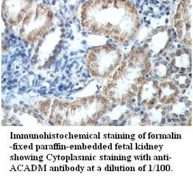 ACADM Antibody from Signalway Antibody (39418) - Antibodies.com