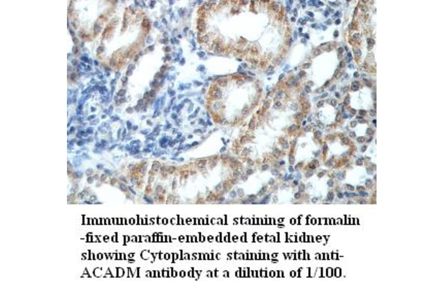 ACADM Antibody from Signalway Antibody (39418) - Antibodies.com