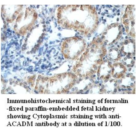 ACADM Antibody from Signalway Antibody (39418) - Antibodies.com