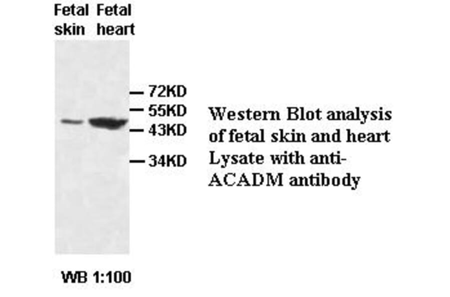 ACADM Antibody from Signalway Antibody (39418) - Antibodies.com