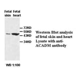 ACADM Antibody from Signalway Antibody (39418) - Antibodies.com