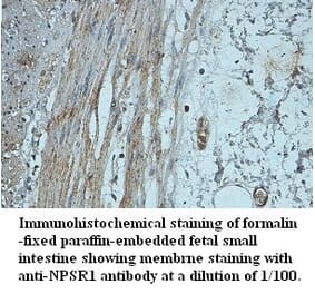 NPSR1 Antibody from Signalway Antibody (39424) - Antibodies.com