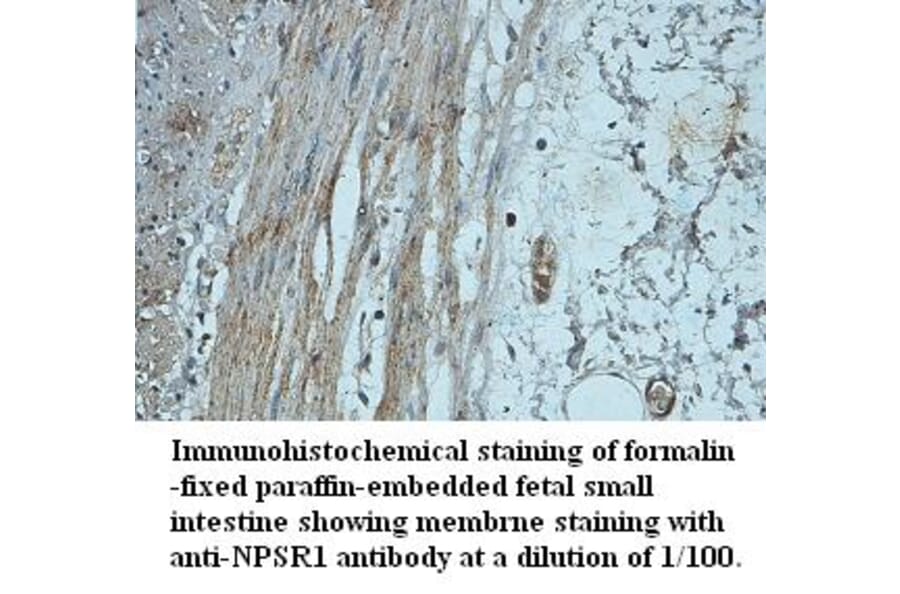NPSR1 Antibody from Signalway Antibody (39424) - Antibodies.com