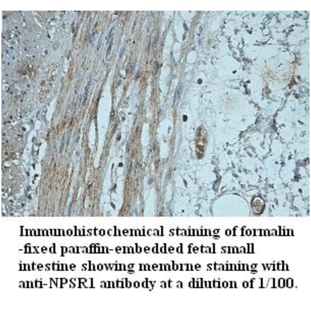 NPSR1 Antibody from Signalway Antibody (39424) - Antibodies.com