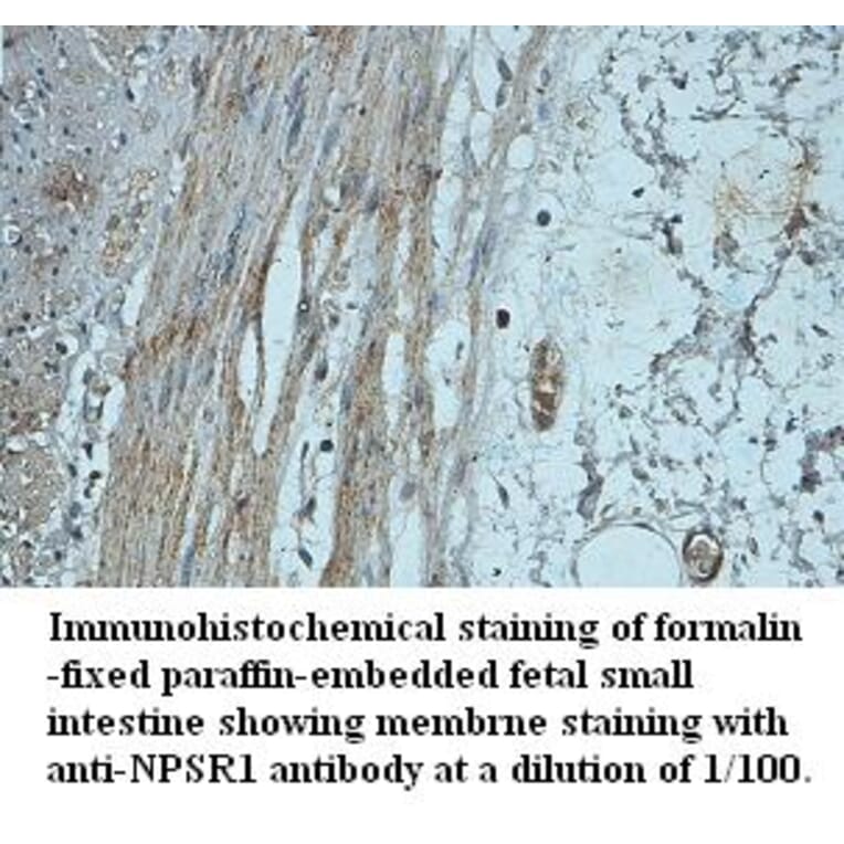NPSR1 Antibody from Signalway Antibody (39424) - Antibodies.com