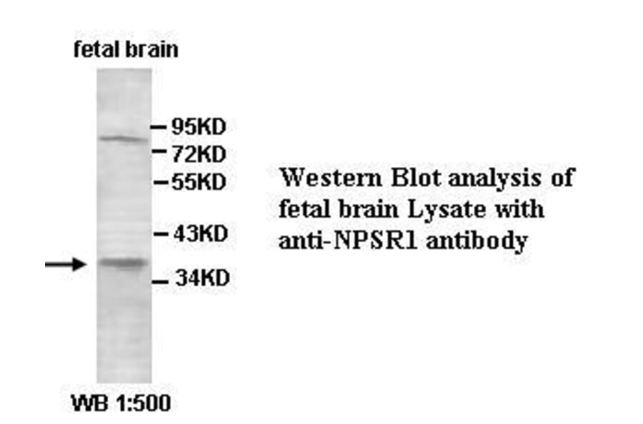 NPSR1 Antibody from Signalway Antibody (39424) - Antibodies.com
