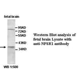 NPSR1 Antibody from Signalway Antibody (39424) - Antibodies.com