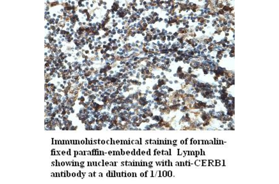 CERB1 Antibody from Signalway Antibody (39430) - Antibodies.com