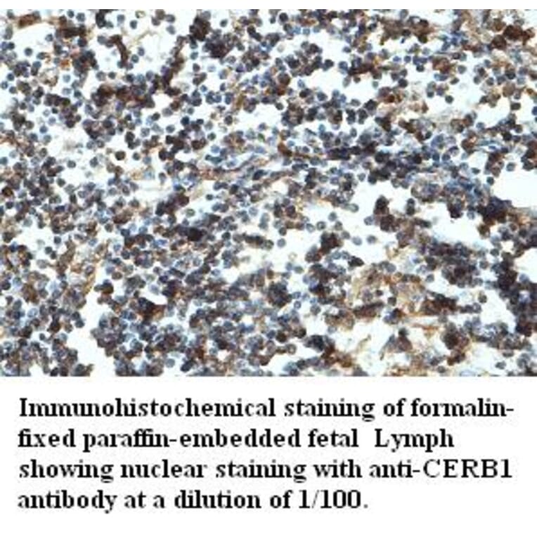 CERB1 Antibody from Signalway Antibody (39430) - Antibodies.com