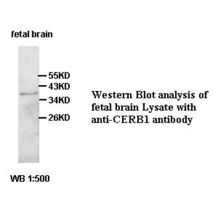 CERB1 Antibody from Signalway Antibody (39430) - Antibodies.com