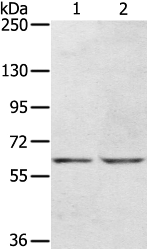 Gel: 6%SDS-PAGE Lysates (from left to right): Hepg2 and HT-29 cell. Amount of lysate: 40ug per lane Primary antibody: 1/400 dilution Secondary antibody dilution: 1/8000Exposure time: 30 seconds