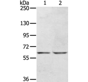 KCNH6 Antibody from Signalway Antibody (40058) - Antibodies.com