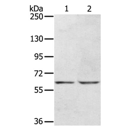 KCNH6 Antibody from Signalway Antibody (40058) - Antibodies.com