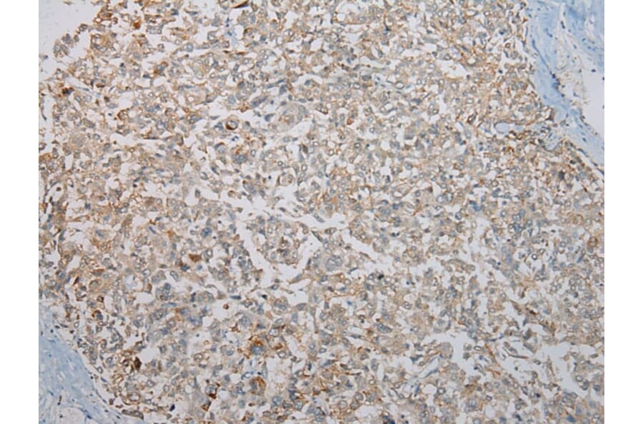 Immunohistochemistry - KCNH6 Antibody from Signalway Antibody (40058) - Antibodies.com