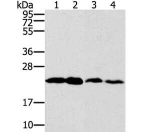 RAB9A Antibody from Signalway Antibody (40067) - Antibodies.com