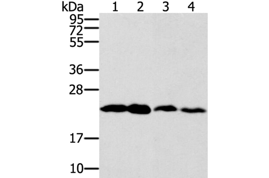RAB9A Antibody from Signalway Antibody (40067) - Antibodies.com