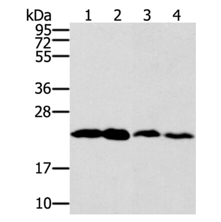 RAB9A Antibody from Signalway Antibody (40067) - Antibodies.com