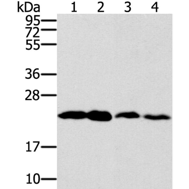 RAB9A Antibody from Signalway Antibody (40067) - Antibodies.com