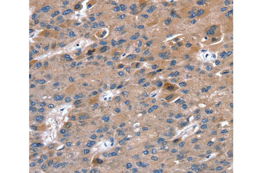 Immunohistochemistry - RAB9A Antibody from Signalway Antibody (40067) - Antibodies.com