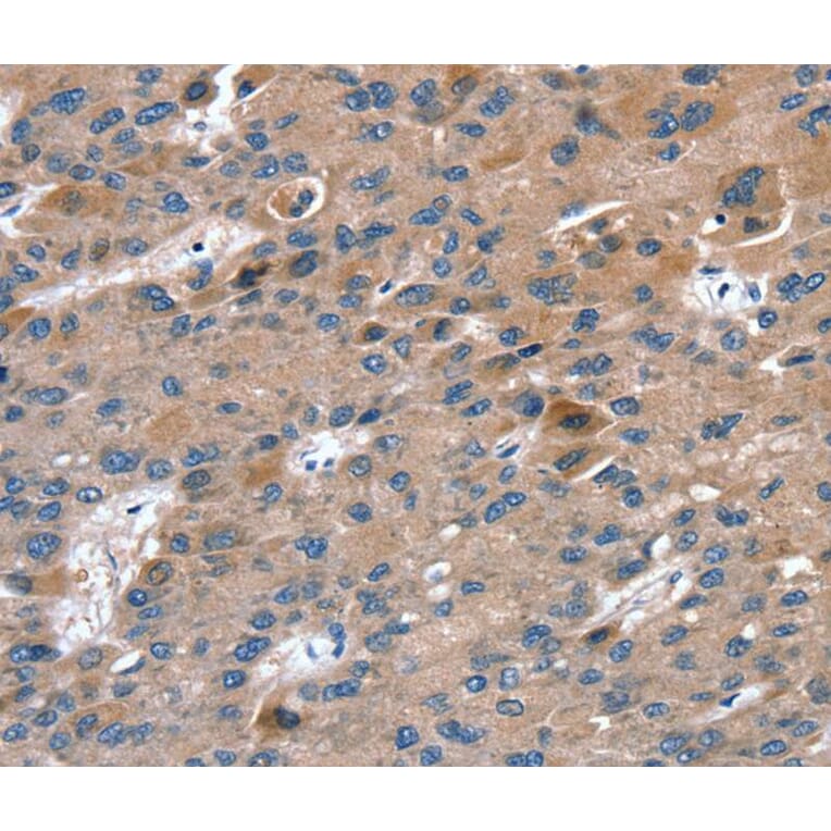 Immunohistochemistry - RAB9A Antibody from Signalway Antibody (40067) - Antibodies.com
