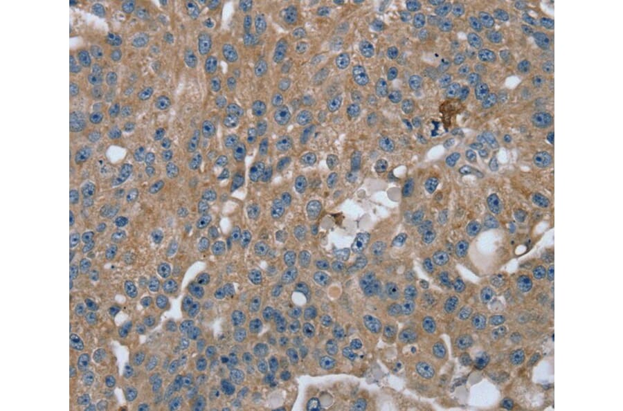 Immunohistochemistry - RAB9A Antibody from Signalway Antibody (40067) - Antibodies.com