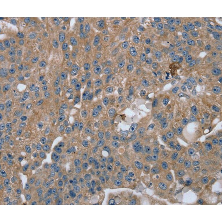 Immunohistochemistry - RAB9A Antibody from Signalway Antibody (40067) - Antibodies.com