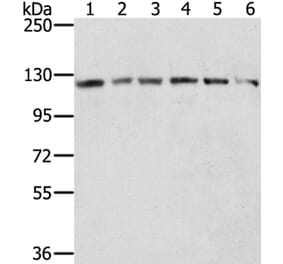 RNF20 Antibody from Signalway Antibody (40080) - Antibodies.com