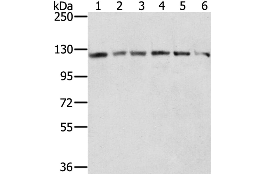 RNF20 Antibody from Signalway Antibody (40080) - Antibodies.com