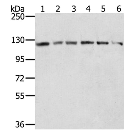 RNF20 Antibody from Signalway Antibody (40080) - Antibodies.com